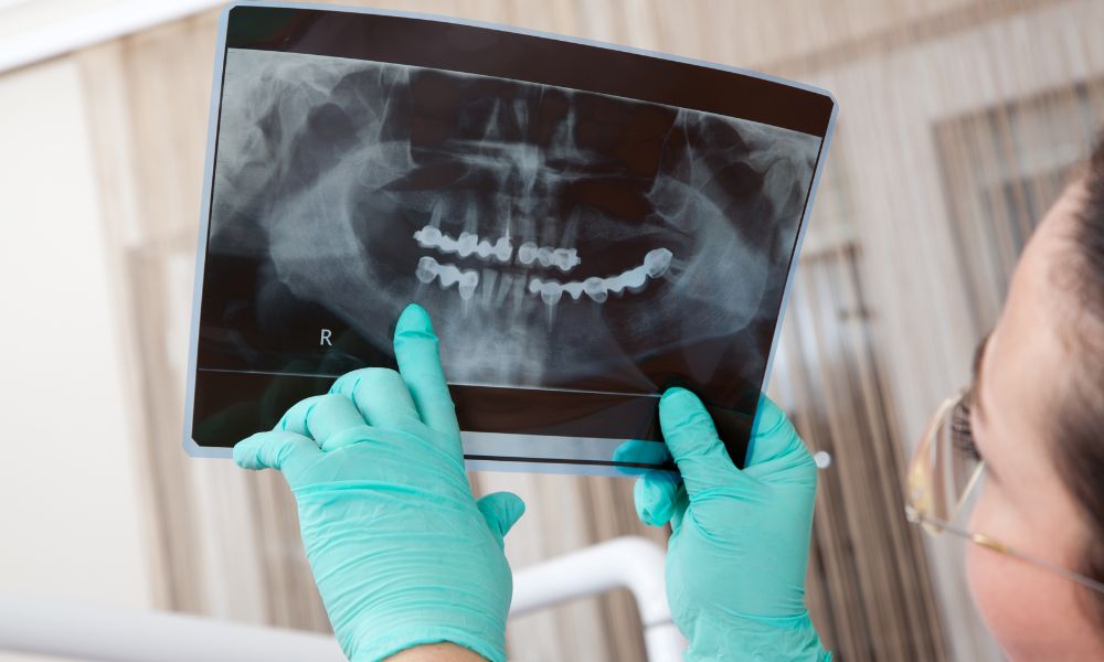 what dental procedures does the VA cover